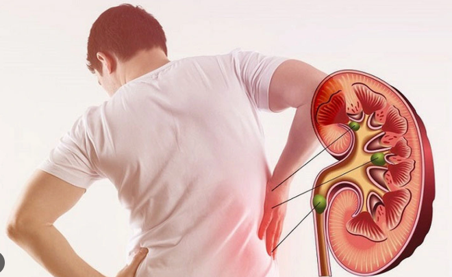 Người đàn ông suy thận giai đoạn 3 ân hận vì tự ý làm điều này khiến bệnh trầm trọng hơn - Ảnh 1.