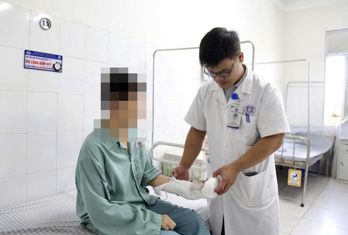 Gia tănTai nạn pháo nổ dịp Tết: Nhiều ca dập nát bàn tay, bác sĩ cảnh báo khẩng tai nạn do pháo tự chế dịp Tết: Nhiều ca dập nát bàn tay, phải cắt cụt để giữ mạng sống - Ảnh 1.