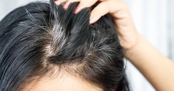 Người tóc bạc sớm có thực sự ít nguy cơ mắc ung thư hơn? Bằng chứng khoa học