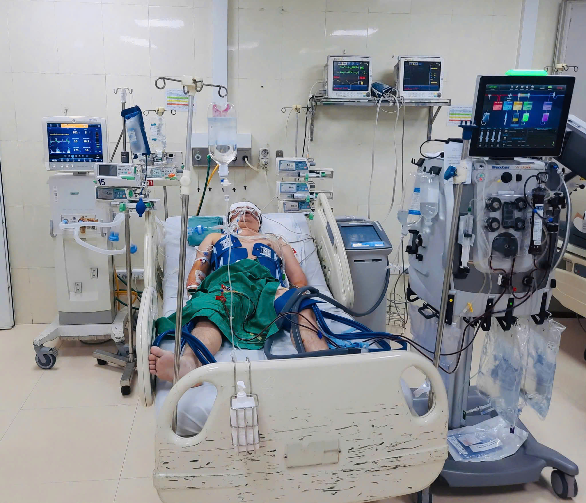 Người đàn ông 47 tuổi ở Hà Nội được cứu sống ngoạn mục sau ngừng tim 50 phút - Ảnh 1. Người đàn ông 47 tuổi ở Hà Nội được cứu sống ngoạn mục sau ngừng tim 50 phút - Ảnh 1.