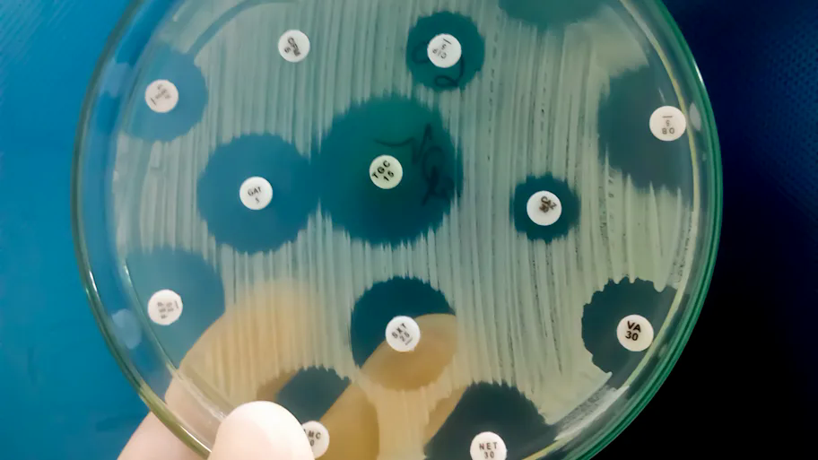 horizontal-antimicrobialsusceptibilitytestinginpetridishantibioticresistanceofbacteria-1771821507325555801865-1771893175024-17718931753901881641325.png