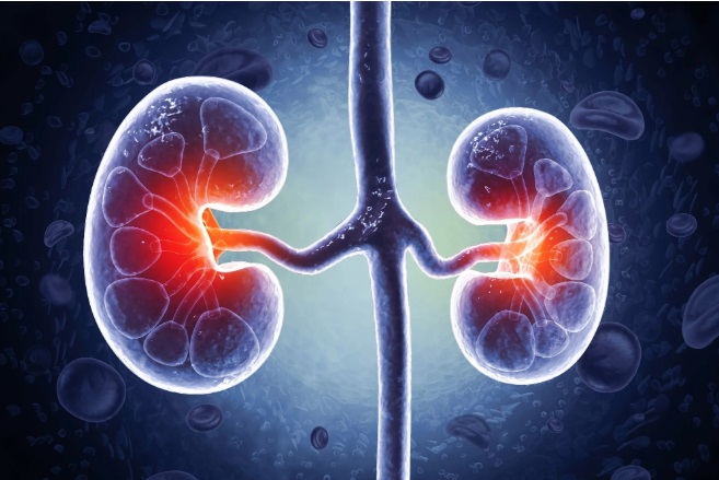 Sau Tết, xuất hiện những dấu hiệu này cần cảnh giác suy thận cấp, người Việt tuyệt đối không bỏ qua - Ảnh 3.