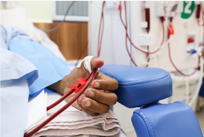 Sau Tết, xuất hiện những dấu hiệu này cần cảnh giác suy thận cấp, người Việt tuyệt đối không bỏ qua - Ảnh 2.