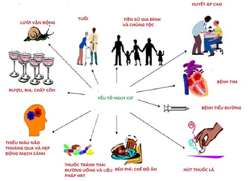 Tai biến mạch m&aacute;u n&atilde;o: Hiểu đ&uacute;ng bệnh để ph&ograve;ng ngừa từ sớm - Ảnh 3.