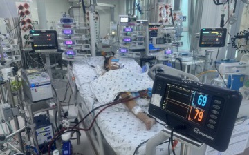 Nữ sinh 17 tuổi sốc tim nguy kịch v&igrave; vi&ecirc;m cơ tim cấp từ 1 dấu hiệu nhiều người Việt bỏ qua - Ảnh 2.