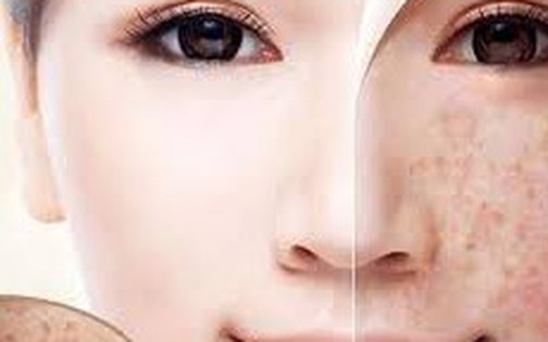 Cảnh báo: Thủ phạm gây đốm đỏ, mụn nước trên da cần nhận diện sớm