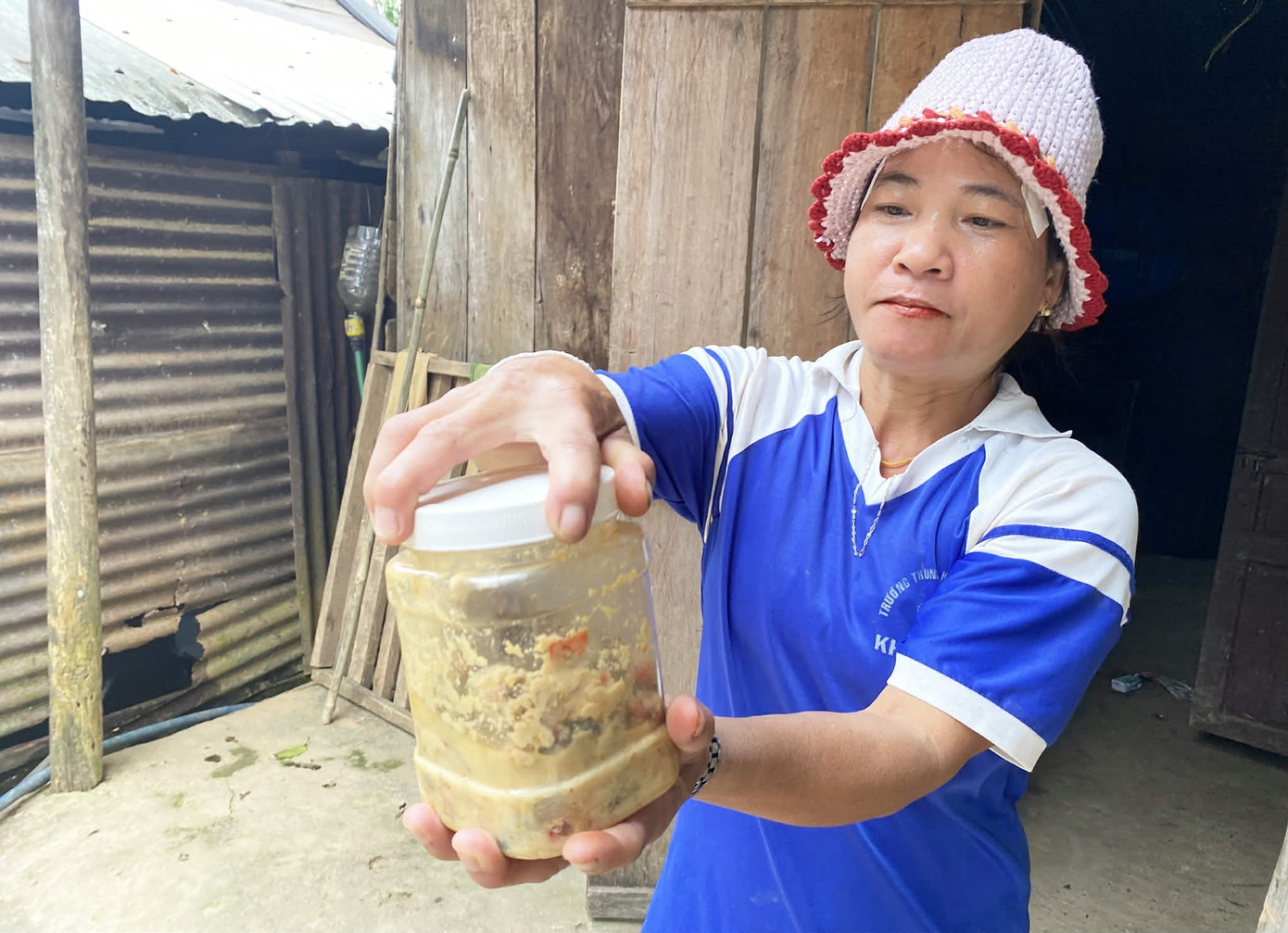 H&eacute; lộ nguy&ecirc;n nh&acirc;n m&oacute;n c&aacute; ủ chua khiến 3 trẻ ở Đ&agrave; Nẵng nguy kịch phải nhờ sự trợ gi&uacute;p từ WHO - Ảnh 1.