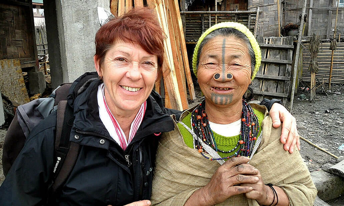 L&agrave;m đẹp kinh dị: "Cải tạo" bản th&acirc;n, đục mũi để đẹp - Ảnh 5.