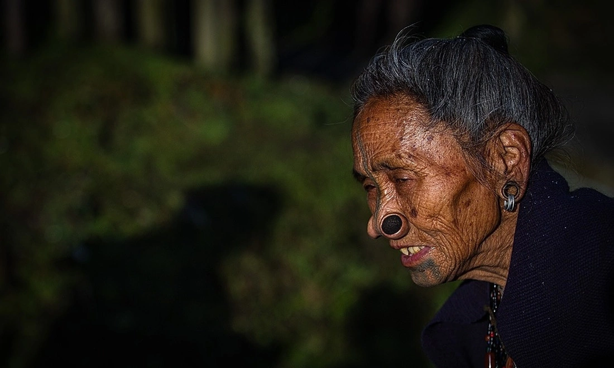 L&agrave;m đẹp kinh dị: "Cải tạo" bản th&acirc;n, đục mũi để đẹp - Ảnh 4.