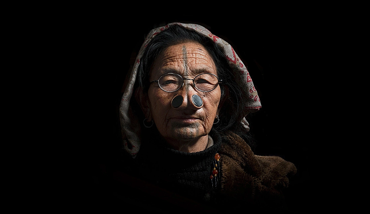 L&agrave;m đẹp kinh dị: "Cải tạo" bản th&acirc;n, đục mũi để đẹp - Ảnh 2.