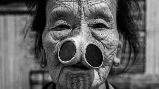 L&agrave;m đẹp kinh dị: "Cải tạo" bản th&acirc;n, đục mũi để đẹp - Ảnh 3.