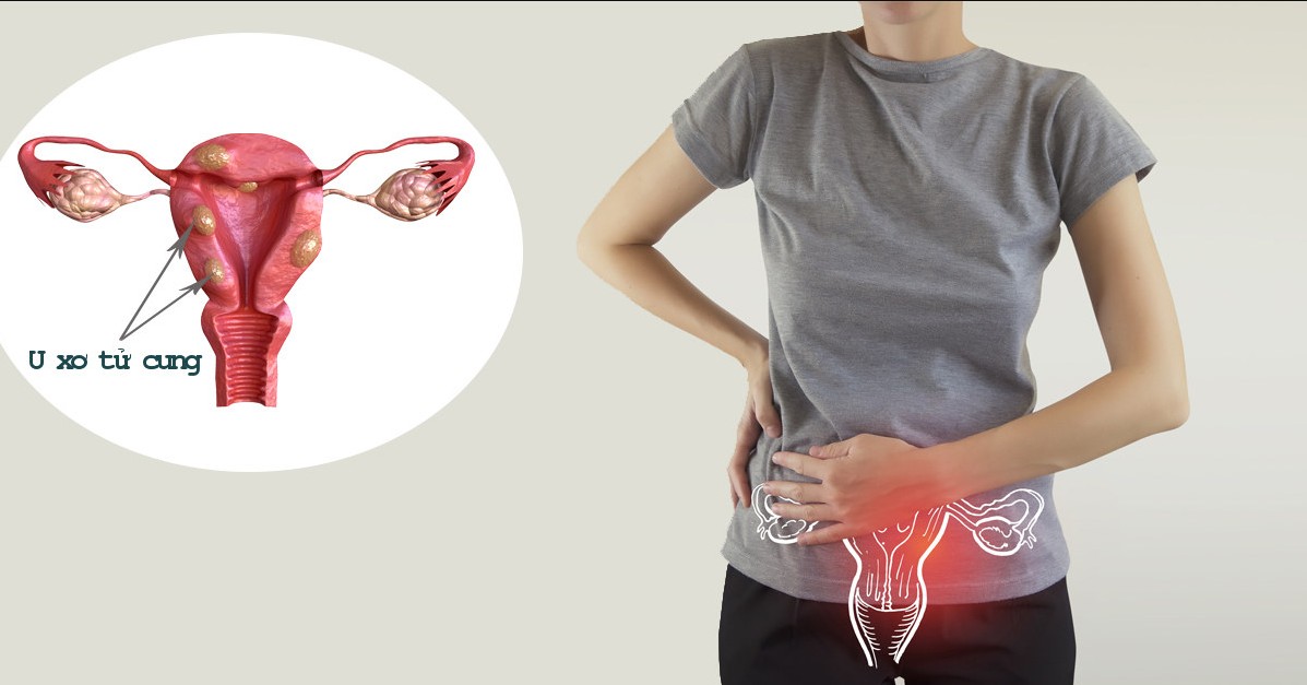 Rong kinh cảnh b&aacute;o bệnh g&igrave;?- Ảnh 3.