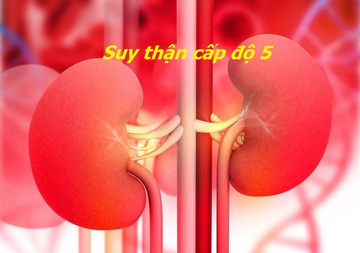 Người đàn ông suy thận giai đoạn cuối ở tuổi 30 vì 1 sai lầm nhiều người Việt mắc phải - Ảnh 2.