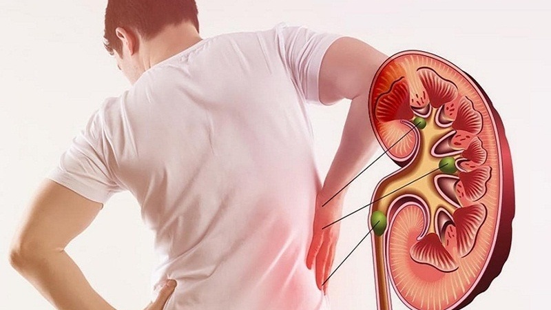 5 dấu hiệu cho thấy thận của nam giới khỏe mạnh: Bạn có bao nhiêu? - Ảnh 2.