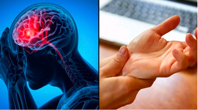 Dấu hiệu nguy hiểm nhất của đột quỵ không phải tê tay chân, nhiều người Việt hiểu lầm mà không biết - Ảnh 1.