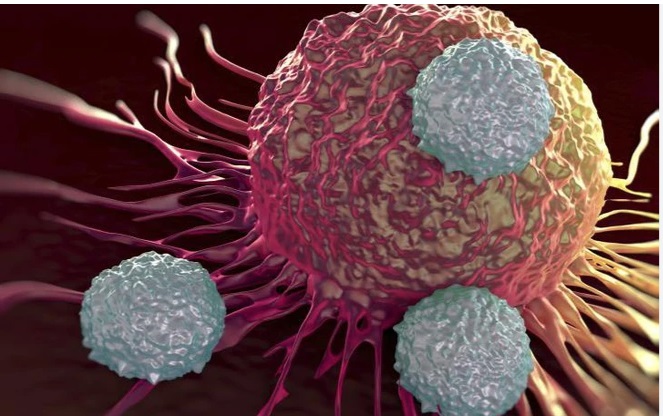 Thanh niên 29 tuổi phát hiện ung thư hiếm gặp từ dấu hiệu nhiều người Việt bỏ qua - Ảnh 2.