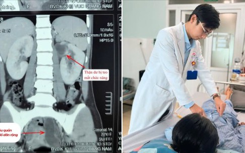 Cô gái 22 tuổi mất chức năng thận vì đi tất hiểm, bác sĩ cảnh báo dấu hiệu dễ bỏ qua