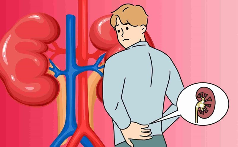 Loại quả đang bán rẻ đầy chợ Việt, người suy thận nên hay không nên ăn: Tùy từng giai đoạn bệnh - Ảnh 2.