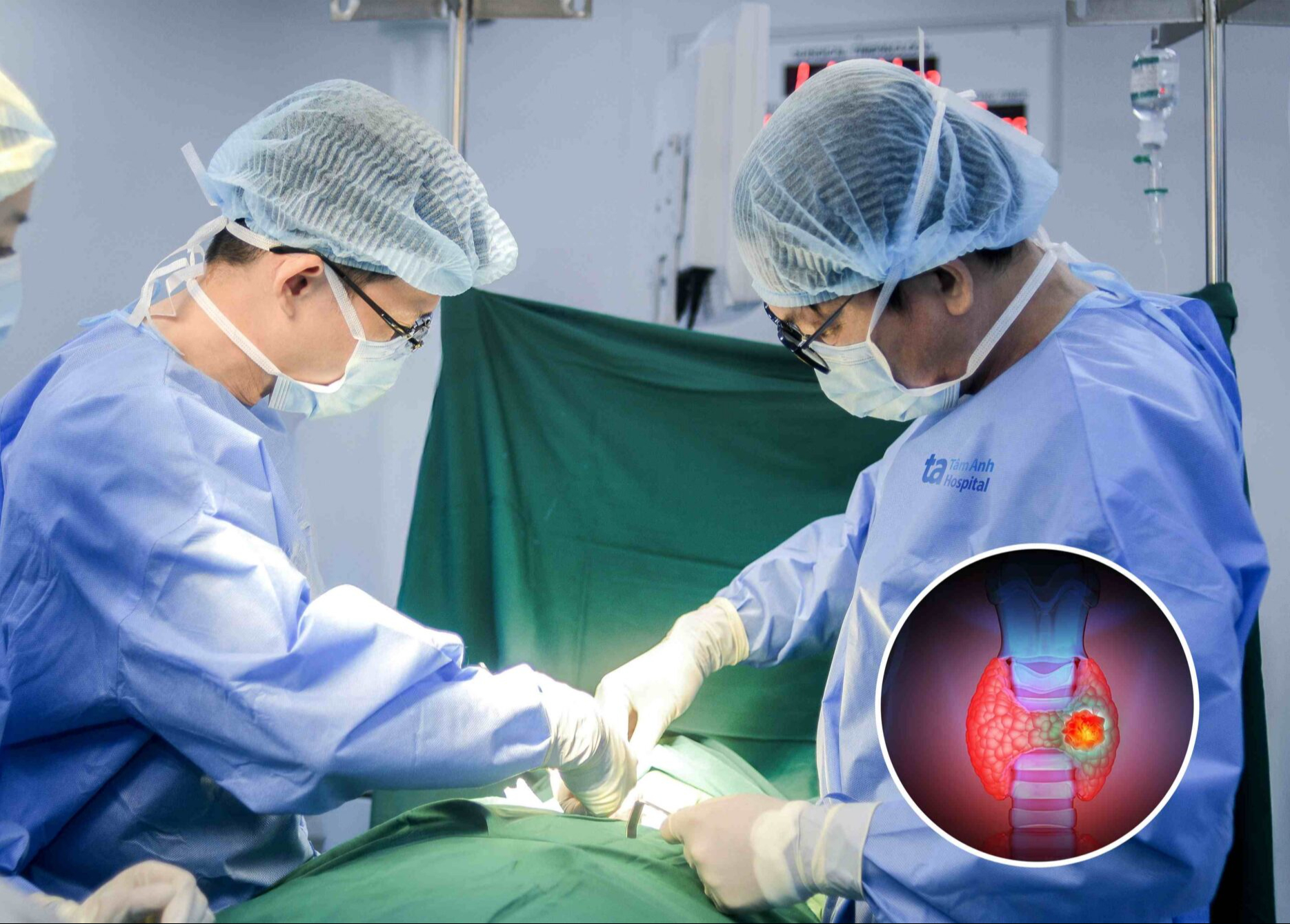 Chia sẻ của người đàn ông 42 tuổi phát hiện mắc ung thư tuyến giáp di căn: Không có triệu chứng - Ảnh 1.