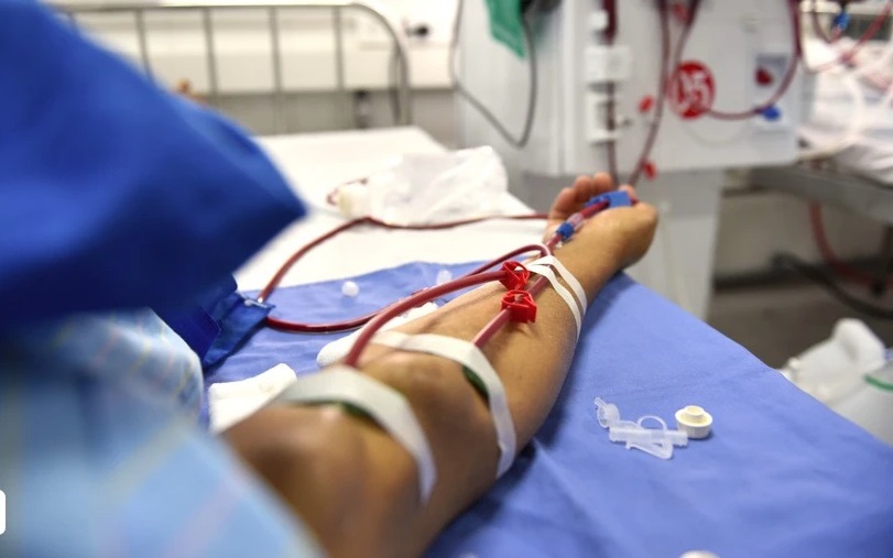 Người bệnh suy thận ăn ổi: Lưu ý quan trọng để duy trì chức năng thận tốt nhất