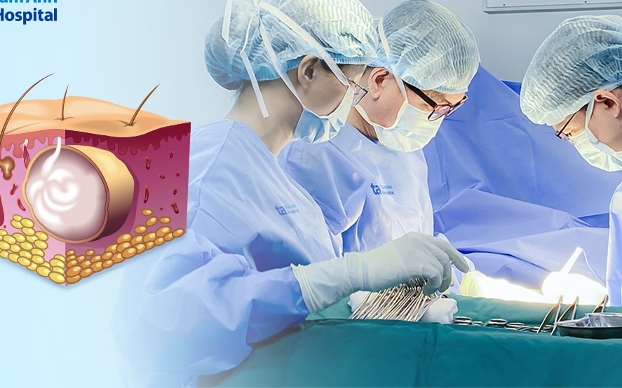 U b&atilde; đậu 10 năm bất ngờ h&oacute;a ung thư ở người đ&agrave;n &ocirc;ng 40 tuổi, dấu hiệu cảnh b&aacute;o nhiều người bỏ qua