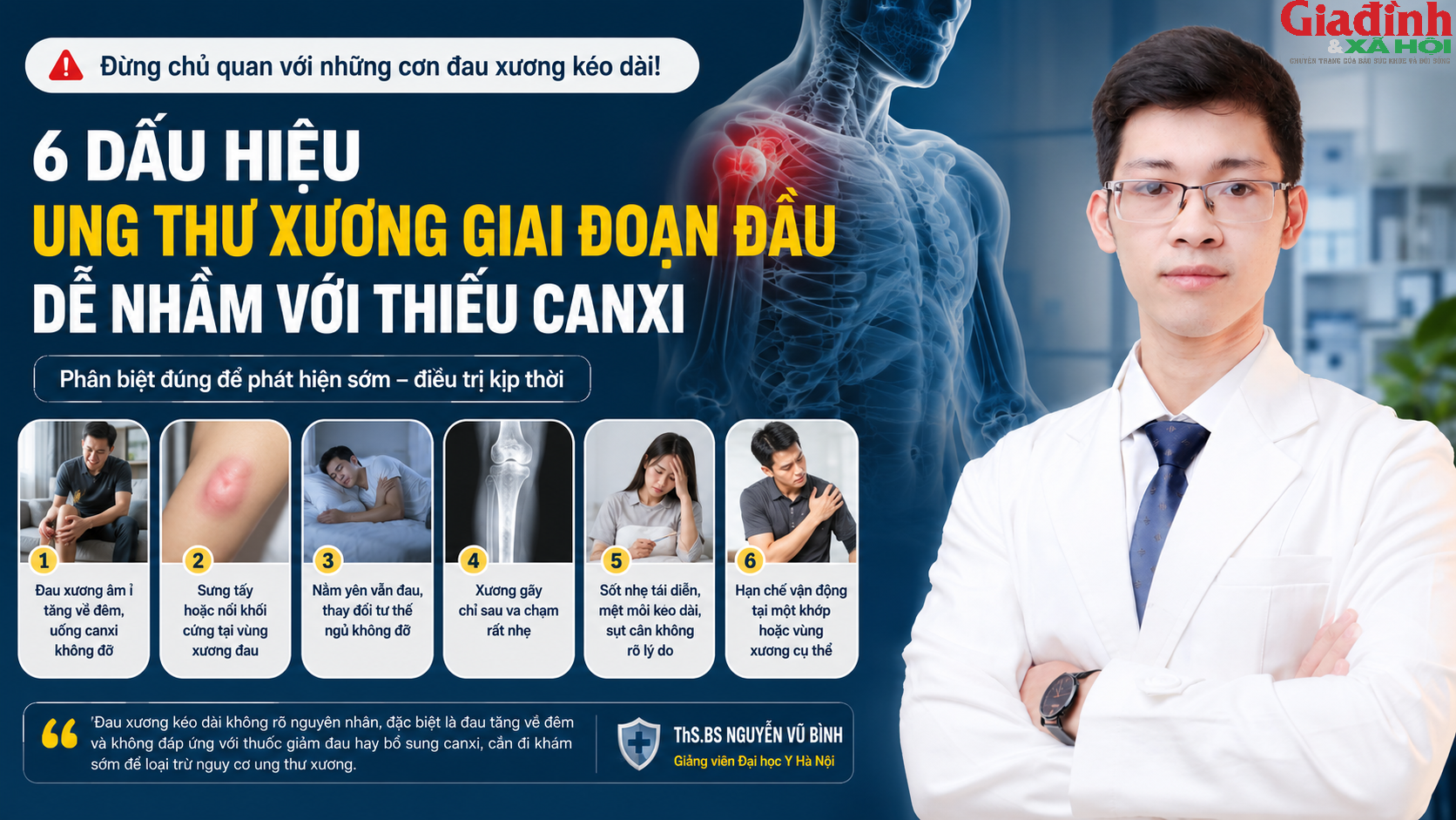 Đau xương kéo dài uống canxi không đỡ? Bác sĩ cảnh báo 6 dấu hiệu ung thư xương giai đoạn đầu dễ bị bỏ qua - Ảnh 2.