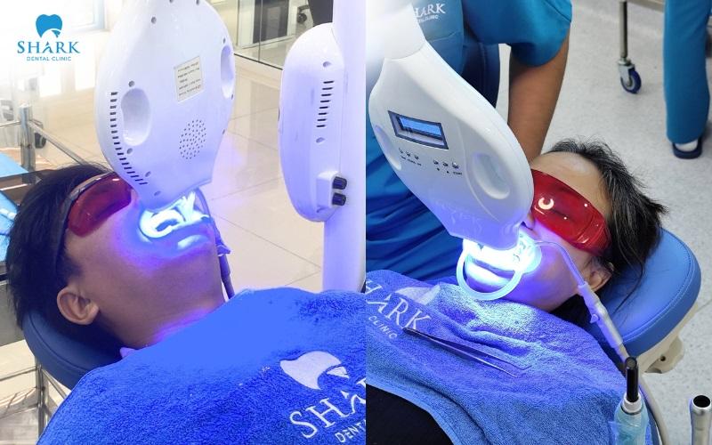Tẩy trắng răng ở đ&acirc;u tốt? Kh&aacute;m ph&aacute; ngay địa chỉ tẩy trắng răng được nhiều kh&aacute;ch h&agrave;ng tin chọn - Ảnh 3.