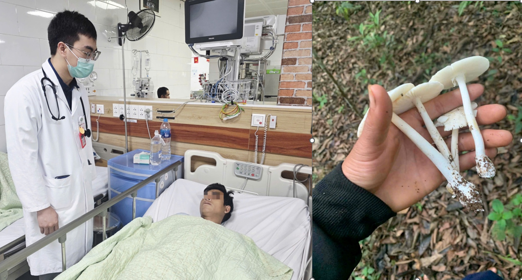 2 người tử vong vì viêm gan, suy gan cấp, suy đa tạng nguy kịch vì sai lầm khi ăn nấm tự hái - Ảnh 1.