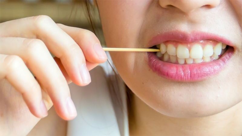Những điều cần lưu &yacute; khi d&ugrave;ng chỉ nha khoa để bảo vệ sức khỏe răng miệng - Ảnh 2.