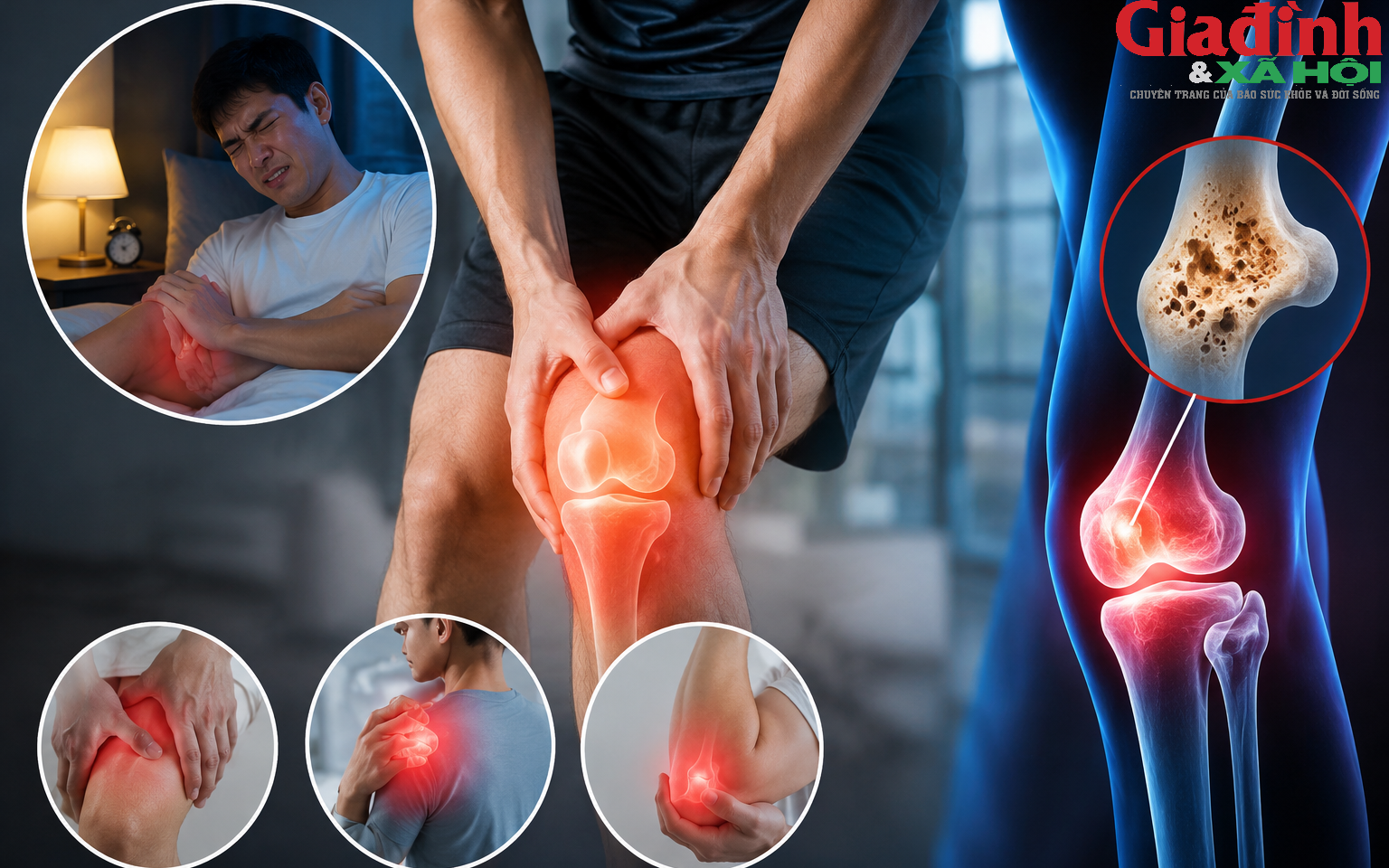 Đau xương về đ&ecirc;m ng&agrave;y c&agrave;ng nhiều, dấu hiệu cảnh b&aacute;o kh&ocirc;ng n&ecirc;n bỏ qua