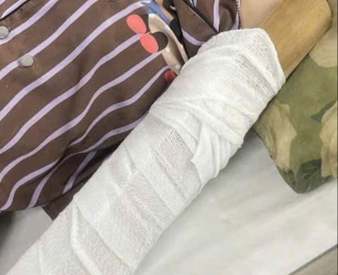 Clip: Kinh hãi cô gái bị máy ép nước mía cuốn xoay nhiều vòng ở TPHCM - Ảnh 2. Kinh hoàng cô gái bị máy ép nước mía cuốn xoay nhiều vòng - Ảnh 1.