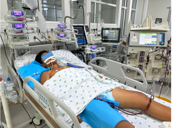 Nắng nóng, thiếu niên 15 tuổi sốc nhiệt nguy kịch, tổn thương gan, thận khi chơi thể thao - Ảnh 1. Nắng nóng, thiếu niên 15 tuổi sốc nhiệt nguy kịch, tổn thương gan, thận khi chơi thể thao - Ảnh 1.