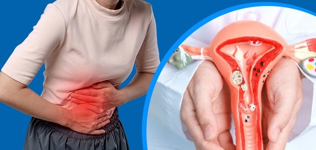 7 dấu hiệu thường gặp của lạc nội mạc tử cung chị em n&ecirc;n ch&uacute; &yacute;- Ảnh 1.