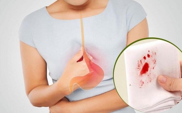 Ung thư đại trực tràng xâm lấn rộng vùng chậu, người đàn ông 58 tuổi được bảo tồn chức năng tiết niệu - Ảnh 3. Ung thư đại trực tràng xâm lấn rộng vùng chậu, người đàn ông 58 tuổi được bảo tồn chức năng tiết niệu - Ảnh 3.