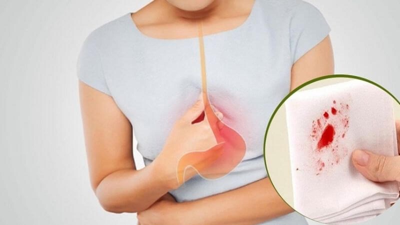 Người phụ nữ 63 tuổi phát hiện ung thư dạ dày từ dấu hiệu nhiều người Việt thường bỏ qua 2 Người phụ nữ 63 tuổi phát hiện ung thư dạ dày từ dấu hiệu nhiều người Việt thường bỏ qua - Ảnh 2.
