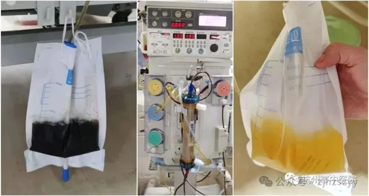 Rắn "cực độc" cắn người đ&agrave;n &ocirc;ng 55 tuổi, chuyện xảy ra sau đ&oacute; khiến ai cũng r&ugrave;ng m&igrave;nh - Ảnh 3.