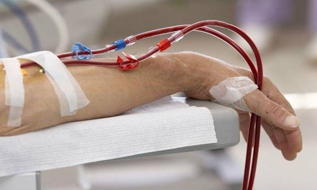 Người phụ nữ huyết &aacute;p tăng cao, đi kh&aacute;m ph&aacute;t hiện suy thận giai đoạn 4 v&igrave; 1 sai lầm nhiều người Việt mắc phải - Ảnh 2.
