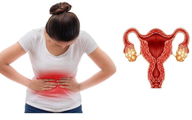 B&eacute; 15 tuổi mắc buồng trứng đa nang, b&aacute;c sĩ chỉ ra sai lầm nhiều trẻ dậy th&igrave; mắc phải - Ảnh 2.
