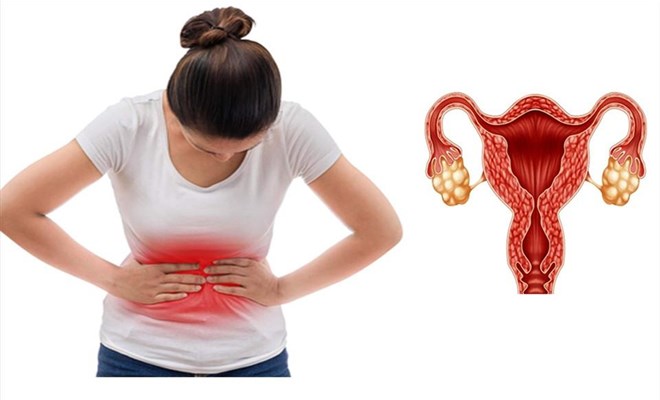 Người phụ nữ 25 tuổi mắc hội chứng buồng trứng đa nang vẫn sinh con khỏe mạnh nhờ làm điều này 1 Người phụ nữ 25 tuổi mắc hội chứng buồng trứng đa nang vẫn sinh con khỏe mạnh nhờ làm điều này - Ảnh 1.