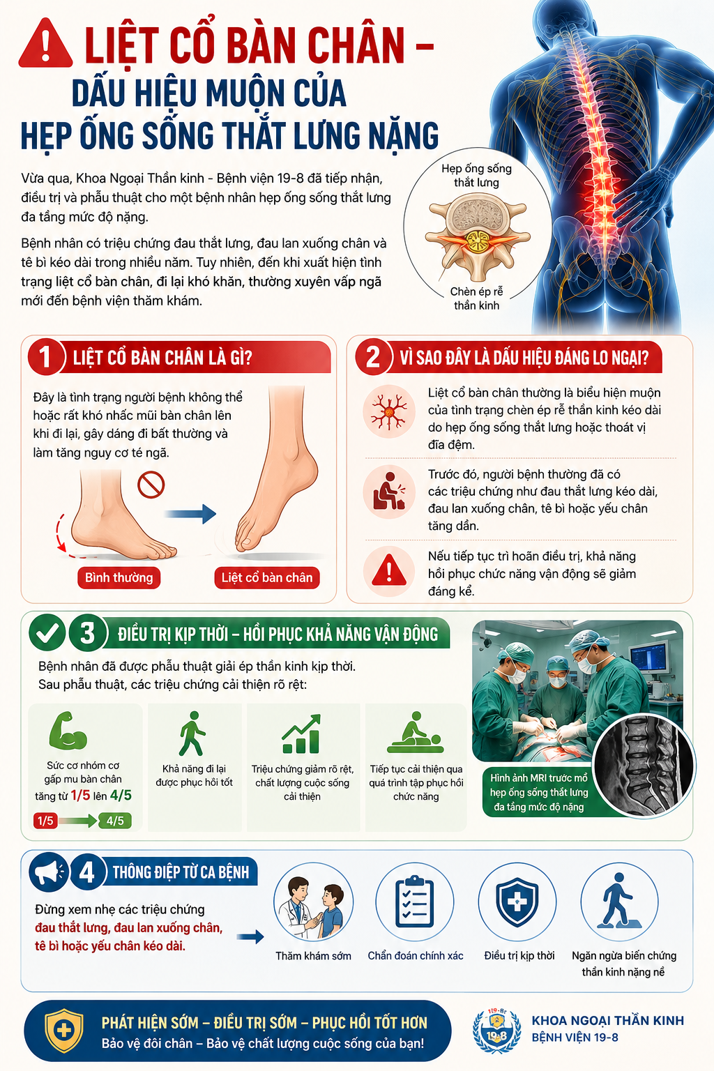 Đừng chủ quan nếu bàn chân bỗng khó nhấc lên: Đây có thể là dấu hiệu muộn của hẹp ống sống thắt lưng - Ảnh 1.