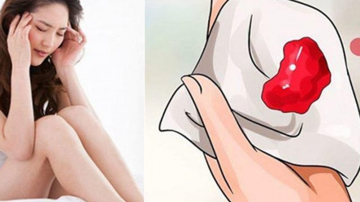 Kinh nguyệt c&oacute; cục m&aacute;u đ&ocirc;ng c&oacute; b&igrave;nh thường kh&ocirc;ng? - Ảnh 1.
