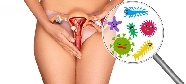 5 nguy&ecirc;n nh&acirc;n g&acirc;y ngứa, vi&ecirc;m phụ khoa, chị em cần biết để ph&ograve;ng bệnh v&agrave; tr&aacute;nh t&aacute;i ph&aacute;t - Ảnh 2.
