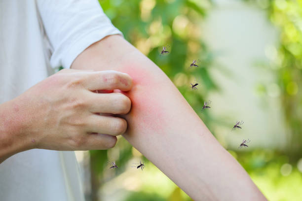 6 kiểu người dễ bị muỗi đốt nhất: Kh&ocirc;ng chỉ do nh&oacute;m m&aacute;u O m&agrave; c&ograve;n v&igrave; những đặc điểm n&agrave;y - Ảnh 1.