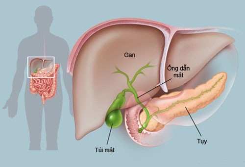 Người phụ nữ 36 tuổi bất ngờ ph&aacute;t hiện đa polyp t&uacute;i mật khi đi kh&aacute;m giảm c&acirc;n - Ảnh 1.