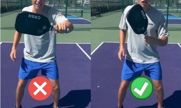 Người chơi pickleball nhất định phải biết điều này để giảm nguy cơ chấn thương - Ảnh 1.
