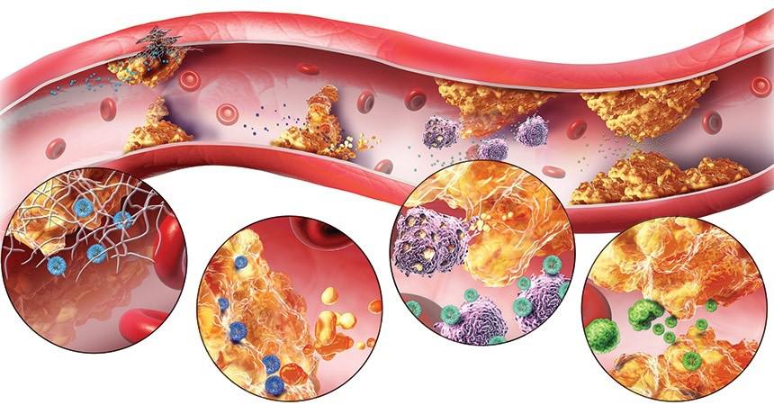 33 tuổi mắc cùng lúc 5 bệnh chuyển hóa nguy hiểm, bác sĩ cảnh báo thói quen nhiều người trẻ mắc phải - Ảnh 2.