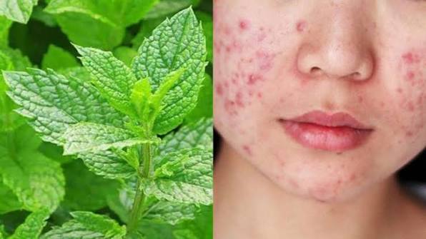 Da mụn n&ecirc;n ăn rau g&igrave; cho m&aacute;t? Mẹo l&agrave;m đẹp da đơn giản từ c&aacute;c loại rau quen thuộc - Ảnh 1.