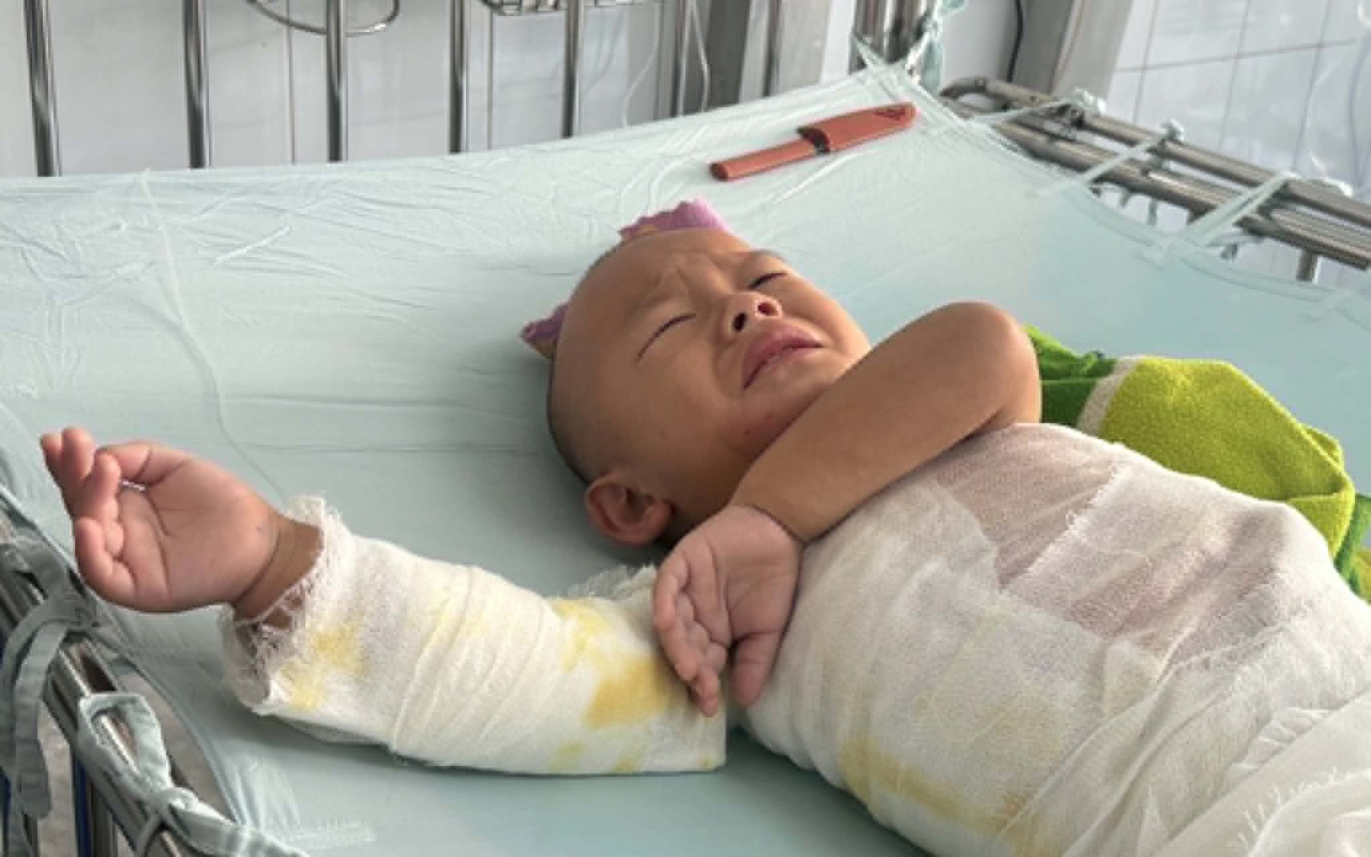 V&ograve;ng tay nh&acirc;n &aacute;i gi&uacute;p ch&agrave;ng trai Th&aacute;i 22 tuổi vượt qua kh&oacute; khăn sau tai nạn - Ảnh 1.