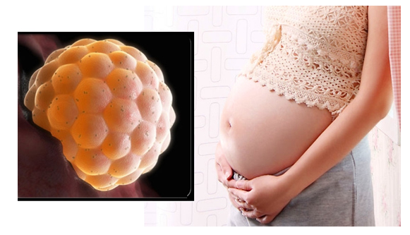 Người phụ nữ 49 tuổi bất ngờ ph&aacute;t hiện chửa trứng từ dấu hiệu nhiều chị em dễ bỏ qua - Ảnh 1.