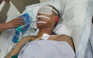 MS 1014: Sự sống mong manh của nam sinh lớp 12 bị sét đánh nguy kịch khi đi phụ mẹ ngoài đồng
